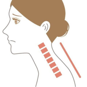 その首の不調、スマホ姿勢が原因かもしれません。