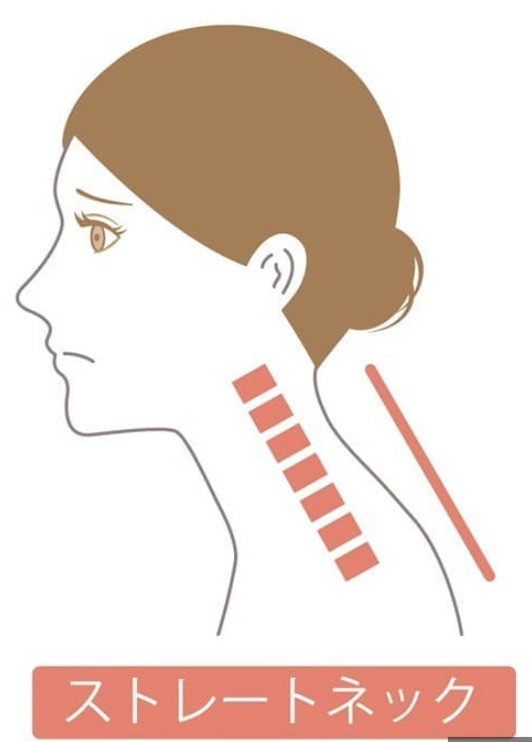 その首の不調、スマホ姿勢が原因かもしれません。